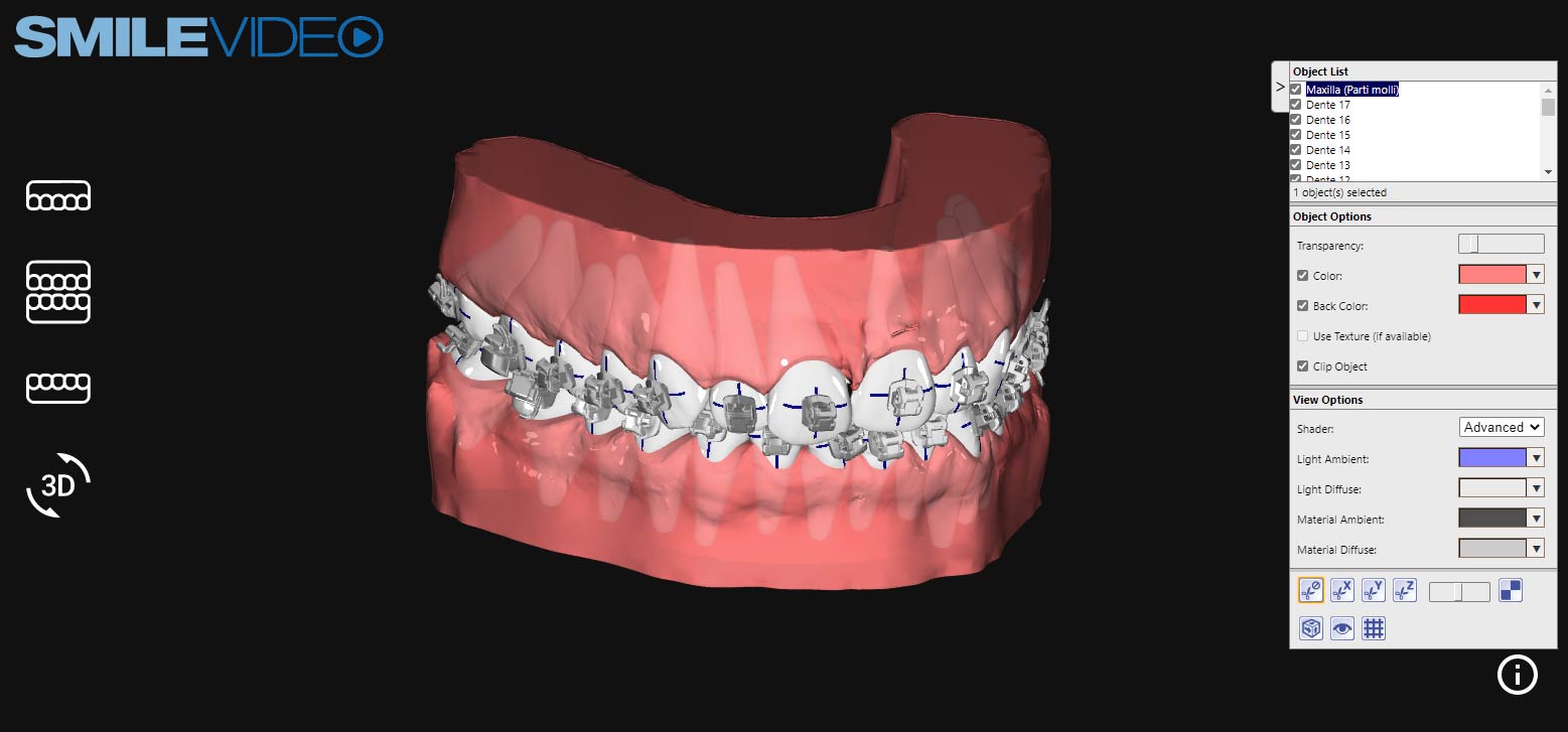 3D prohlížeče - Smiletech - Neviditelná ortodoncie
