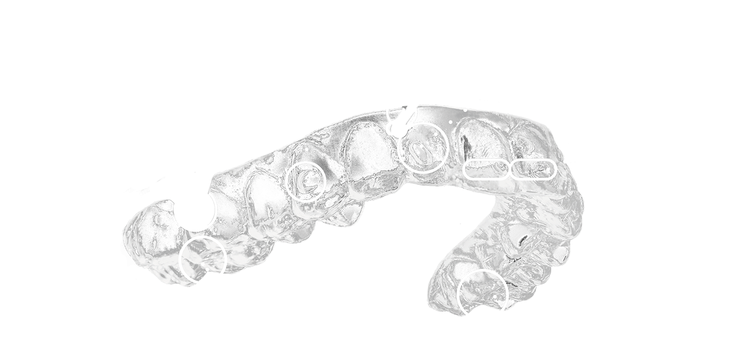 SmileTech - Neviditelná ortodoncie